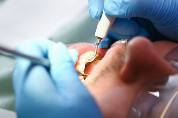 Best Emergency Dental Services for Seniors in El Rancho, NM