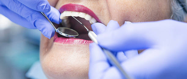 Best Emergency Dentist for Knocked-Out Tooth in El Rancho, NM